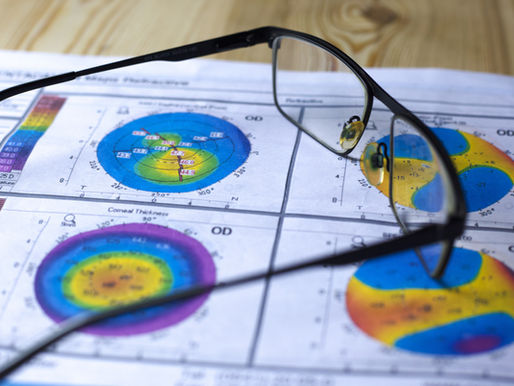 Il cheratocono: quando la cornea si deforma