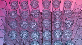 laboratory-test-tubes-filled-with-liquid