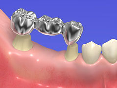 Call Evergreen Dental Group in Kirkland, WA for some of the best cosmetic dental care