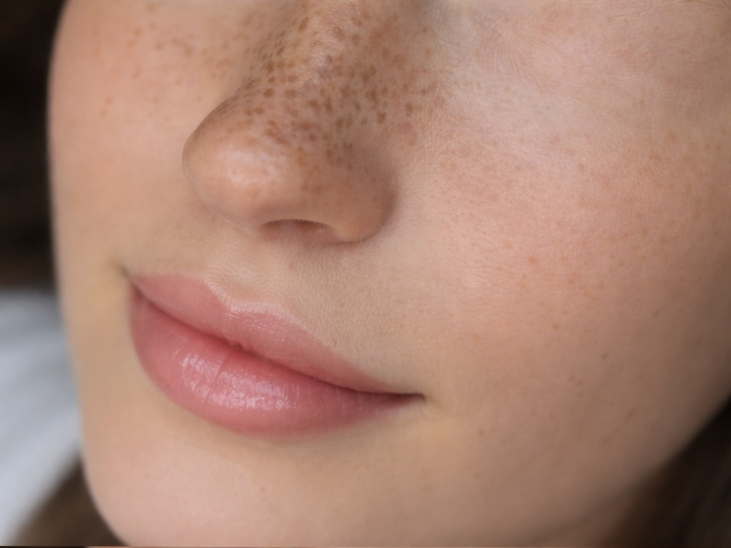 Freckle Tattoo Light Coverage Nose Only — Allure Microblading Auckland