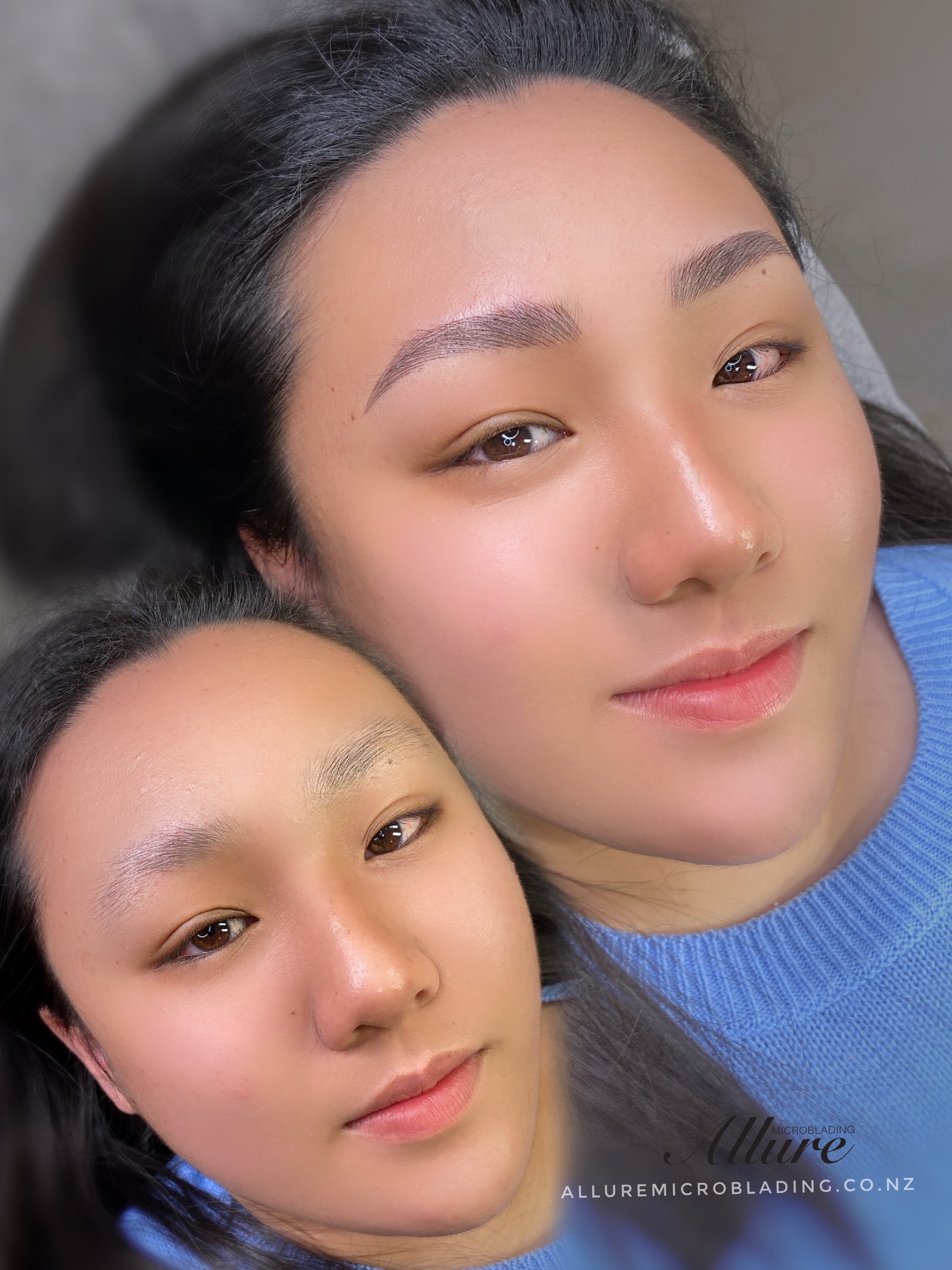 Non-Laser Tattoo Removal before and after