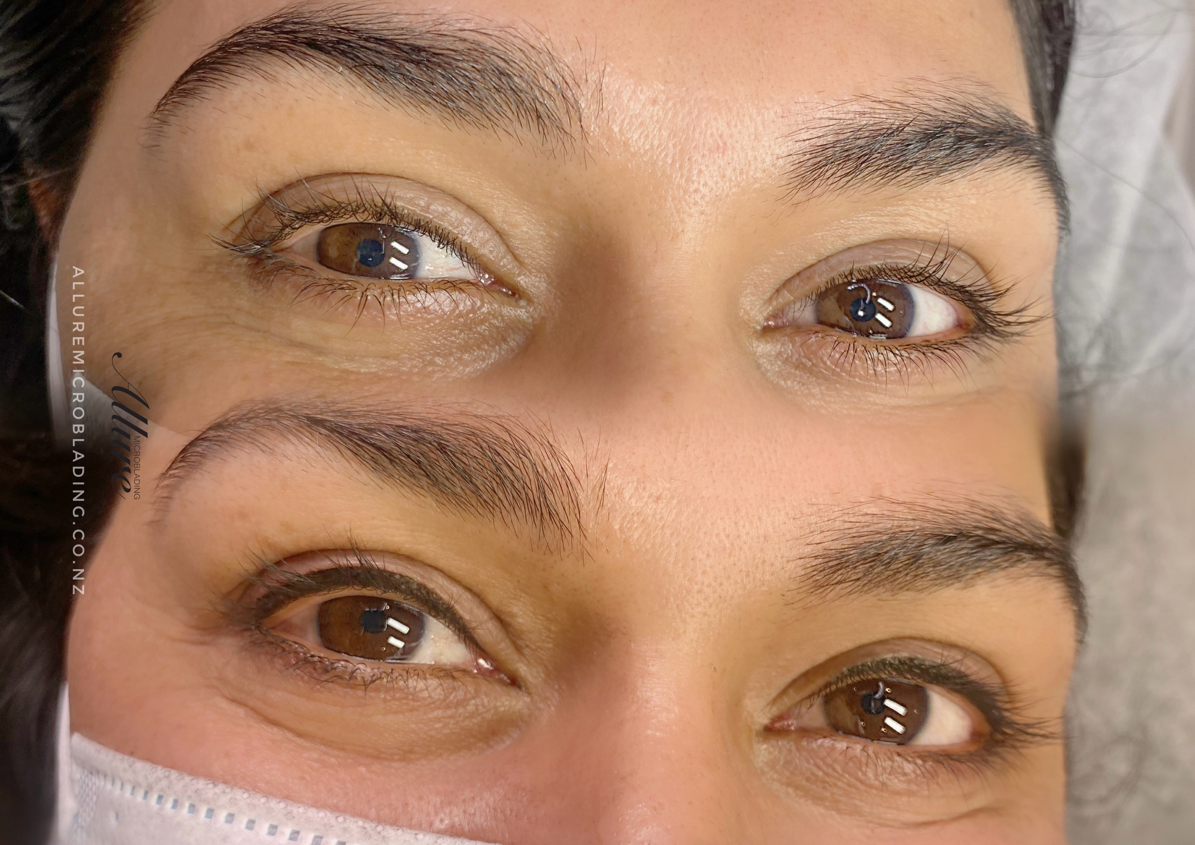 Upper Eyeliner Tattoo before and after