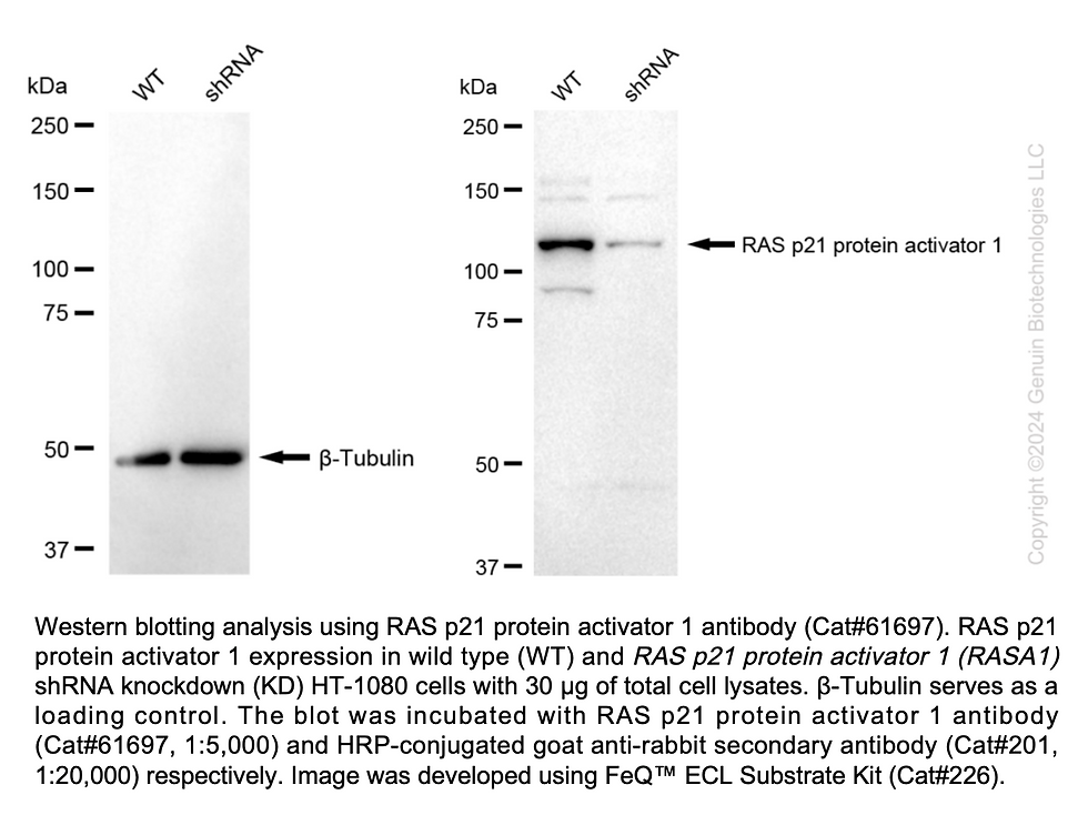 Thumbnail: KD-Validated Anti-RAS P21 Protein Activator 1 Rabbit Monoclonal Ab#61697
