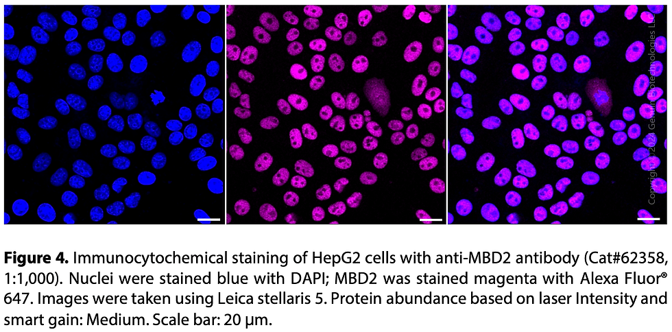 Thumbnail: KD-Validated Anti-Methyl-CpG Binding Domain Protein 2 Rabbit Monoclonal Ab#62358