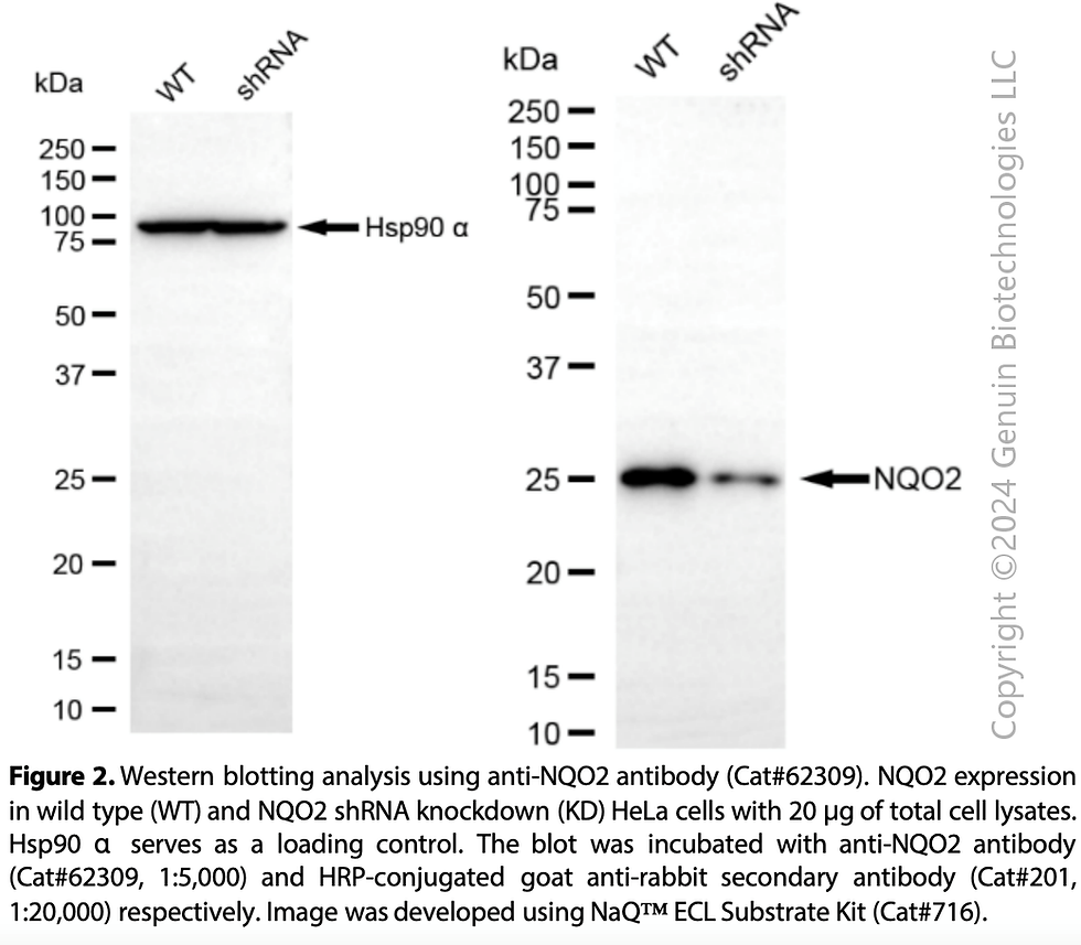 Thumbnail: KD-Validated Anti-NQO2 Rabbit Monoclonal Ab#62309