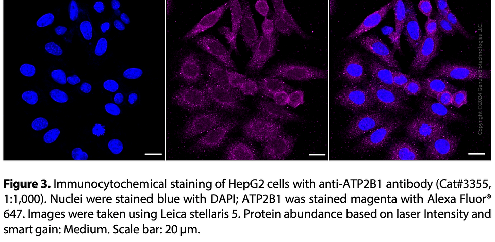 Thumbnail: Anti-ATP2B1 Rabbit mAb #3355