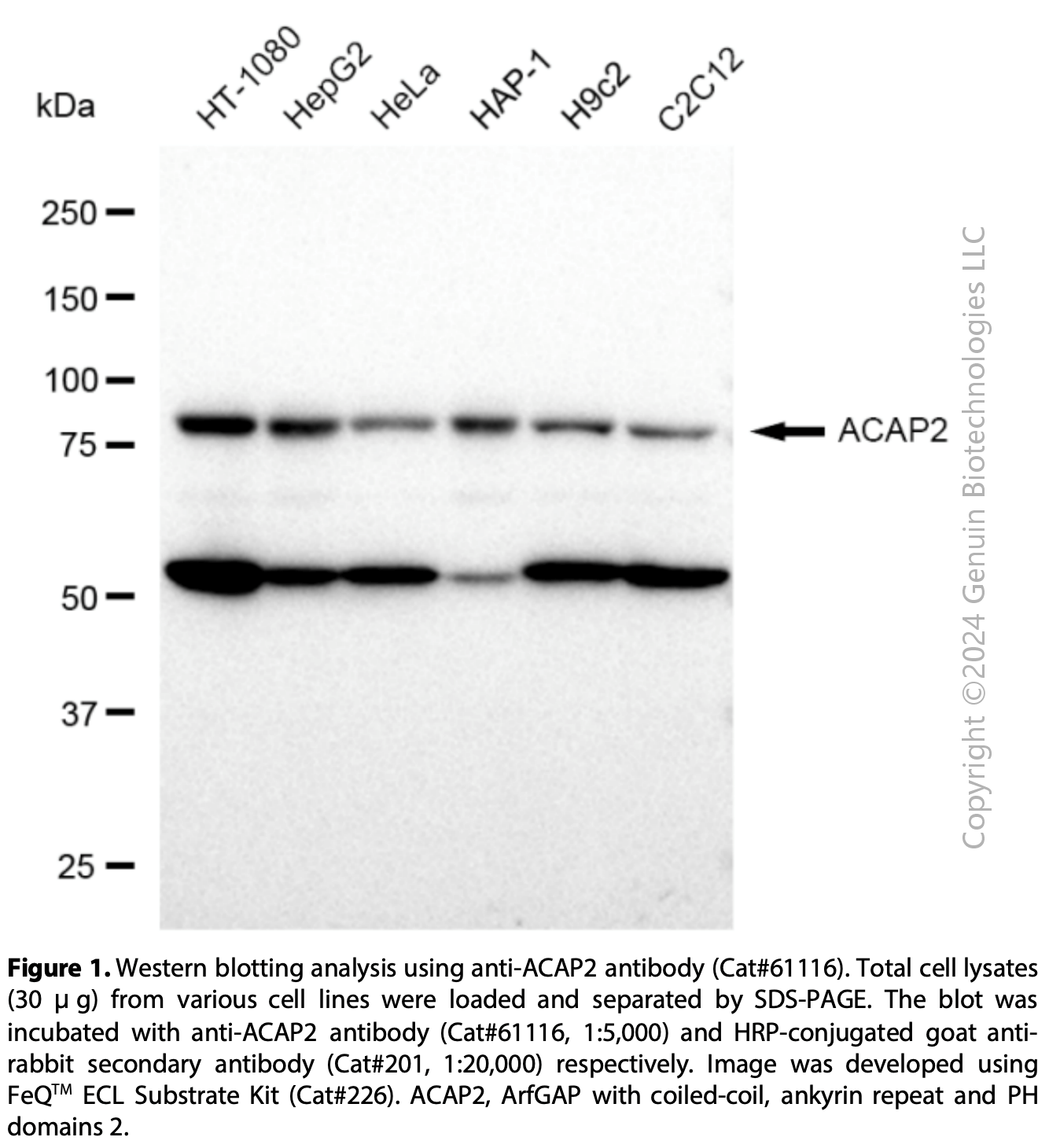 KD-Validated Anti-ACAP2 Rabbit mAb #61116