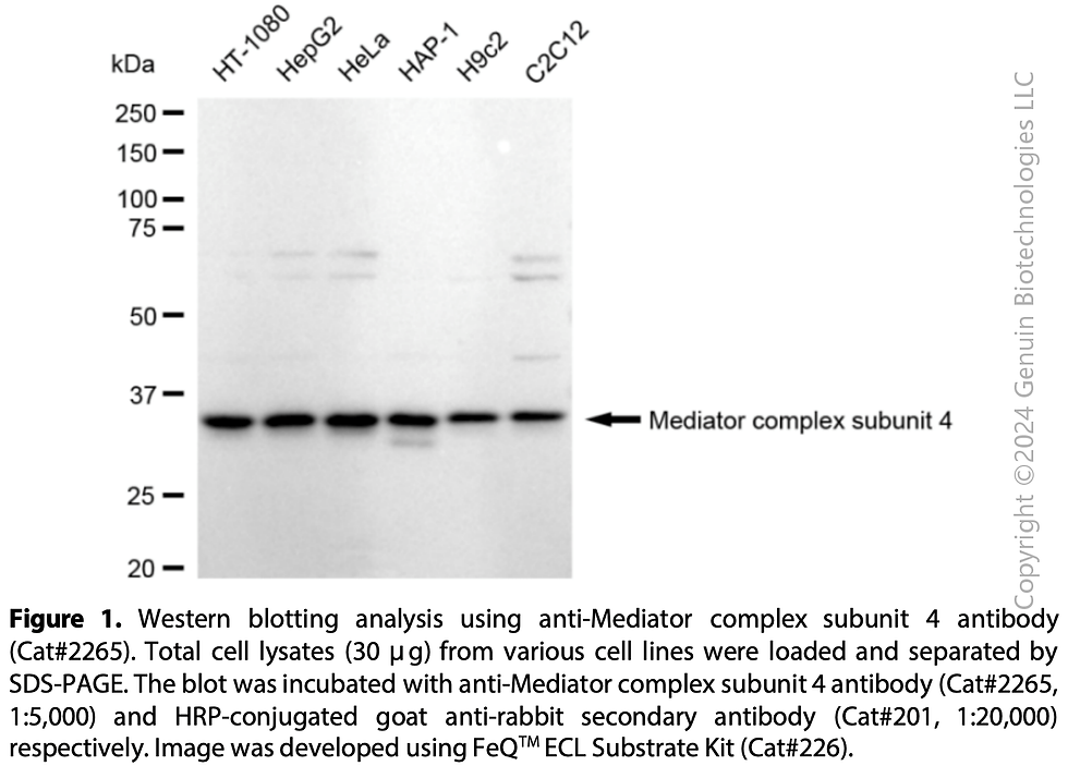 Thumbnail: Anti-Mediator Complex Subunit 4 Rabbit mAb #2265