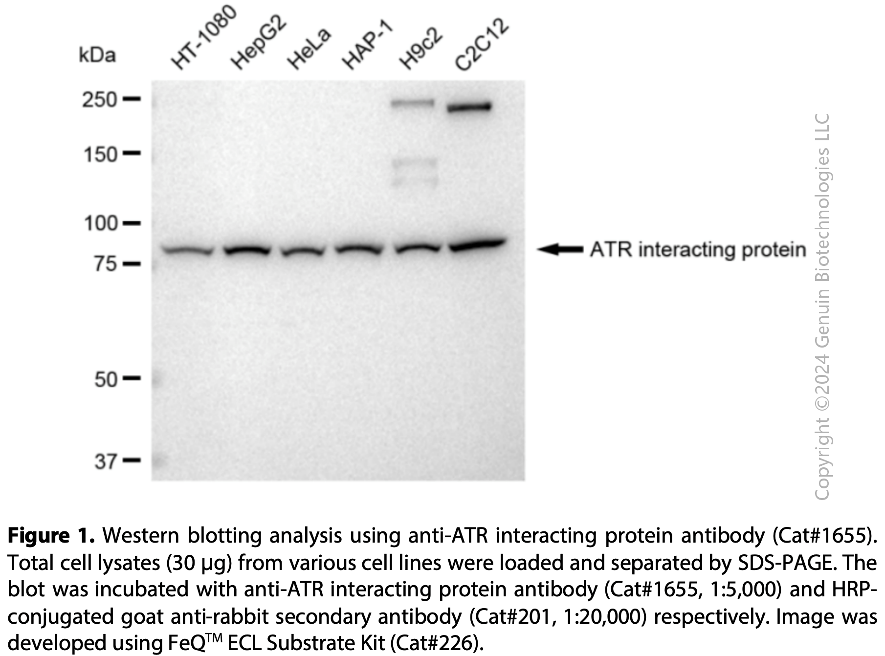 Anti-ATR Interacting Protein Rabbit mAb #1655