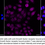 Thumbnail: Anti-Growth factor receptor bound protein 7 Rabbit mAb #2194