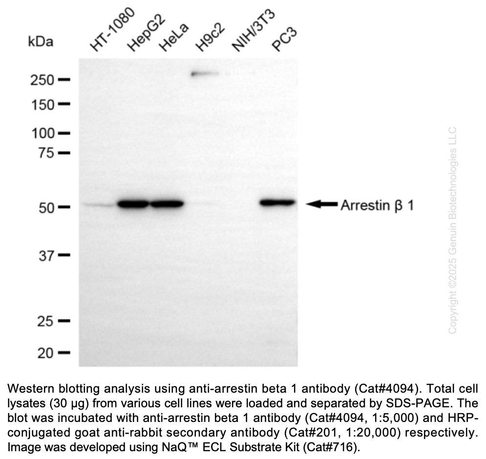 Anti-Arrestin Beta 1 Rabbit Monoclonal Ab #4094 | GenuIN Biotech