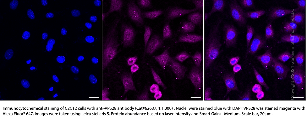 Thumbnail: KD-Validated Anti-VPS28 Subunit Of ESCRT-I Rabbit Monoclonal Ab#62637