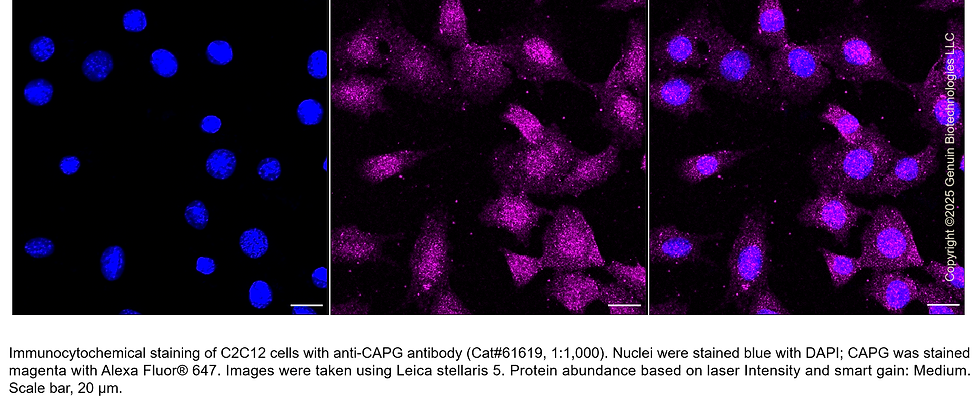 Thumbnail: KD-Validated Anti-CAPG Rabbit Monoclonal Ab #61619