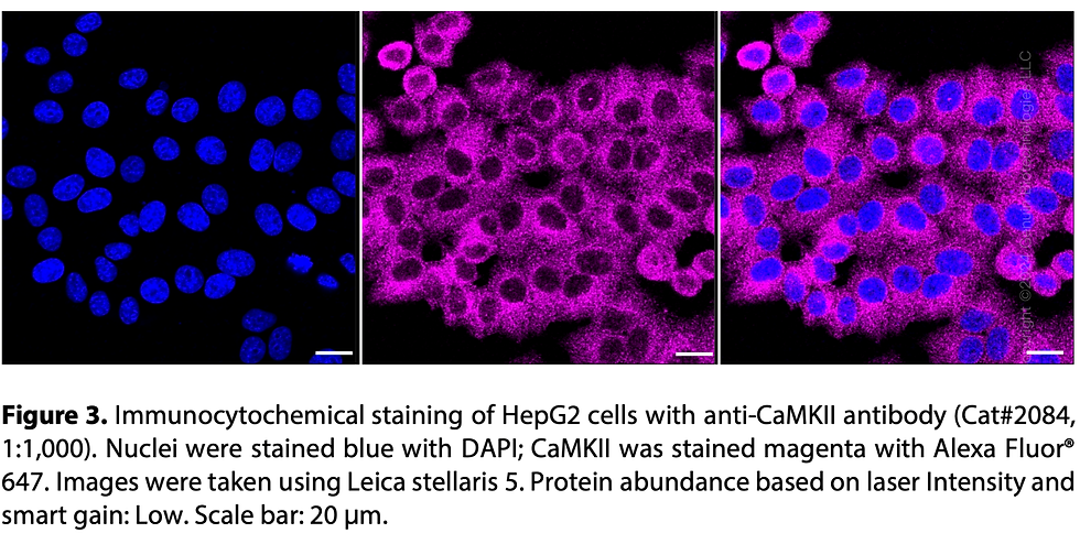Thumbnail: Anti-CaMKII Rabbit mAb #2084