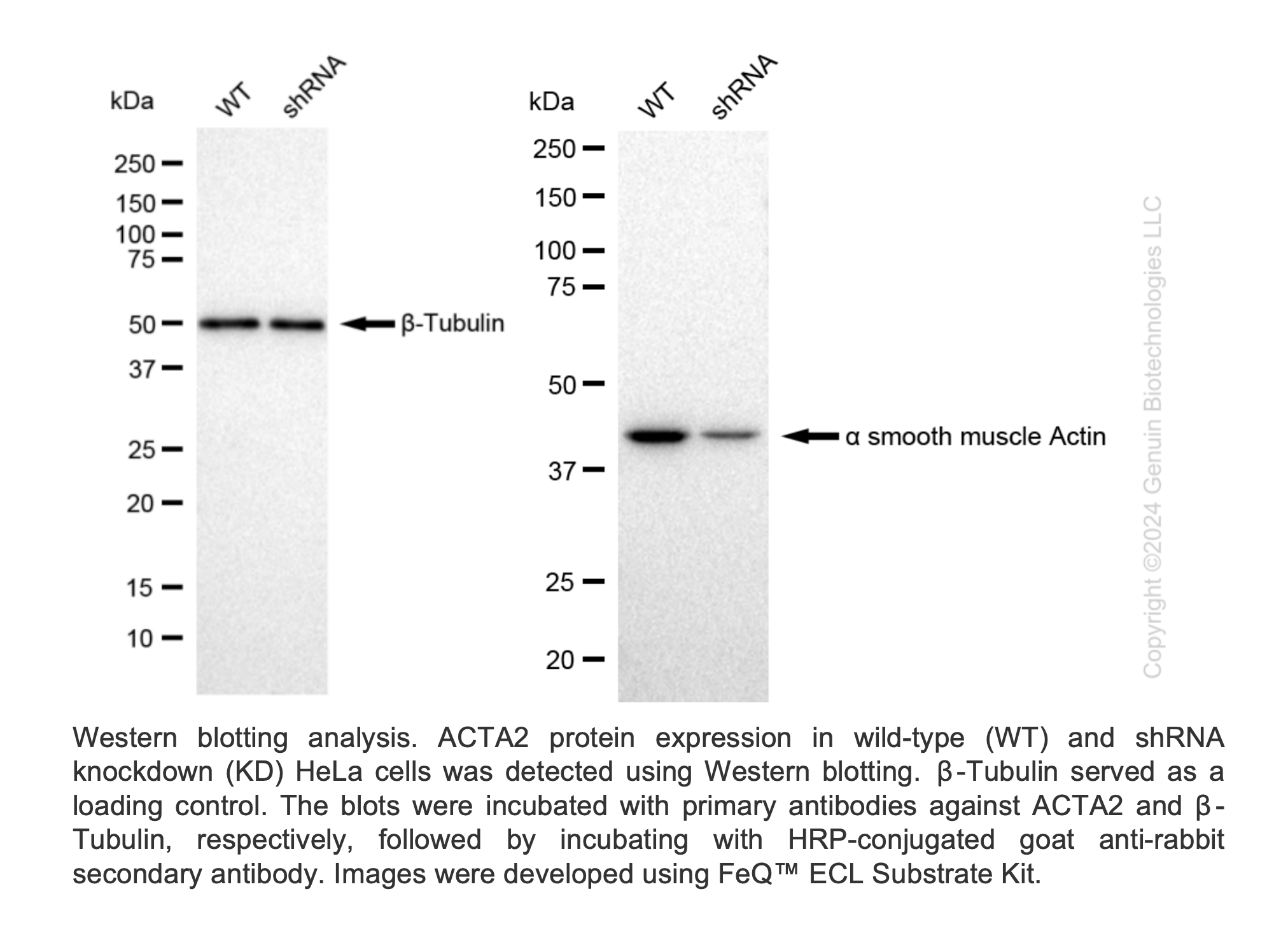 WB-Validated ACTA2 Lentiviral shRNA Knockdown Kit #V69172