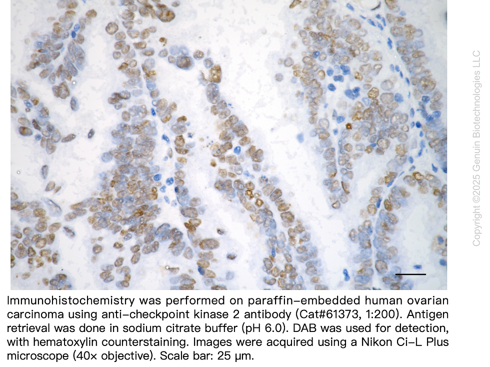 Thumbnail: KD-Validated Anti-Checkpoint Kinase 2 Rabbit Monoclonal Ab#61373