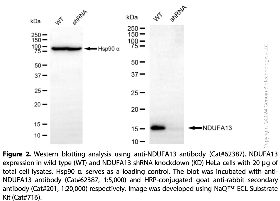 Thumbnail: KD-Validated Anti-NDUFA13 Rabbit Monoclonal Ab#62387