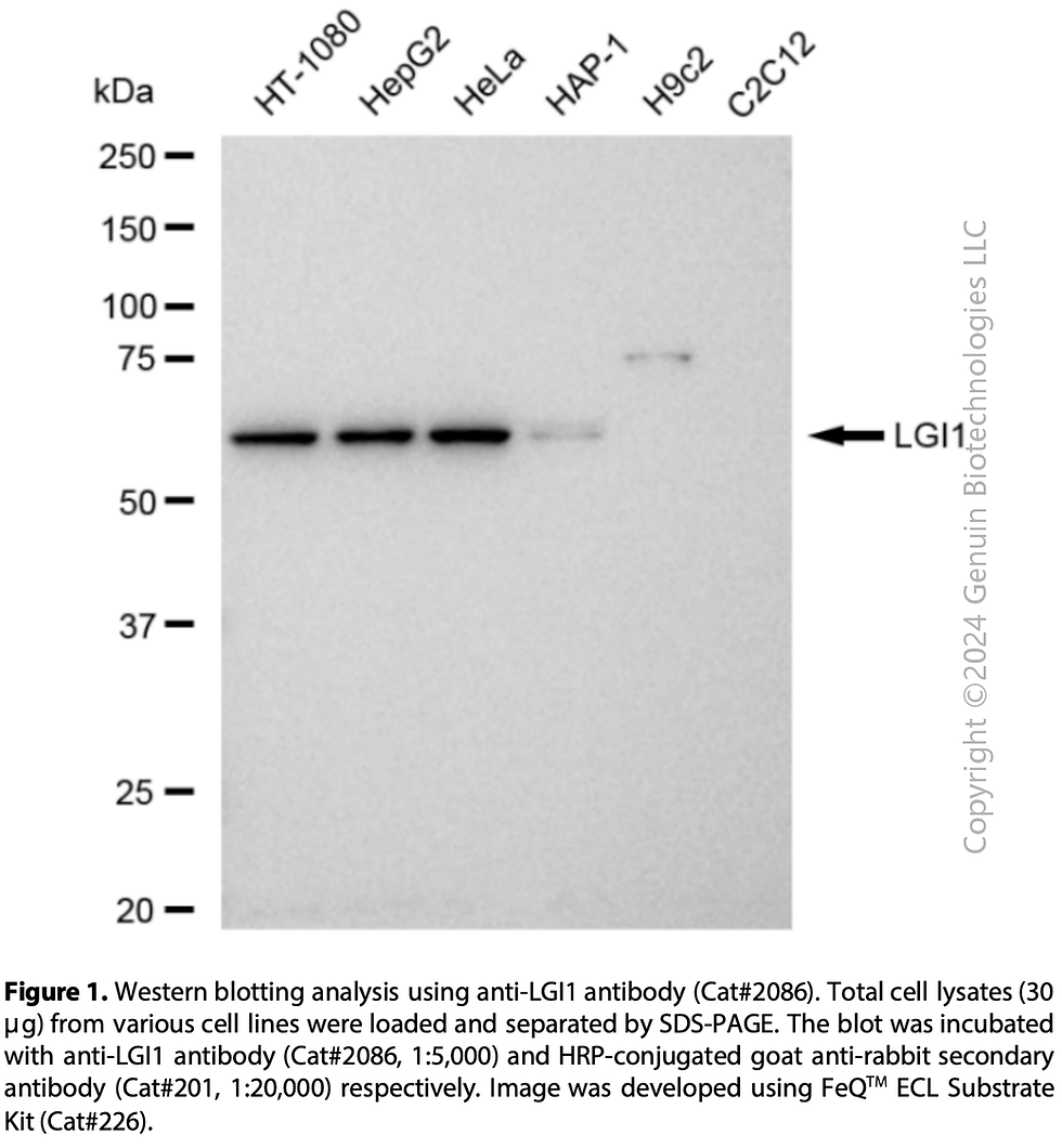 Thumbnail: Anti-LGI1 Rabbit mAb #2086