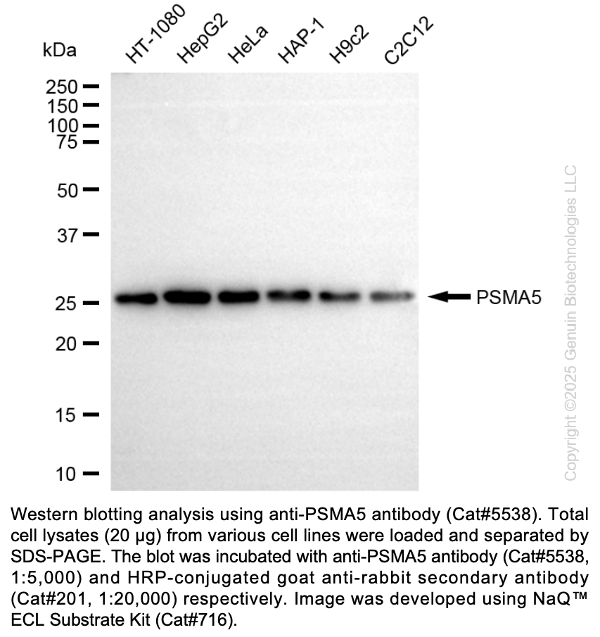Anti-PSMA5 Rabbit mAb #5538