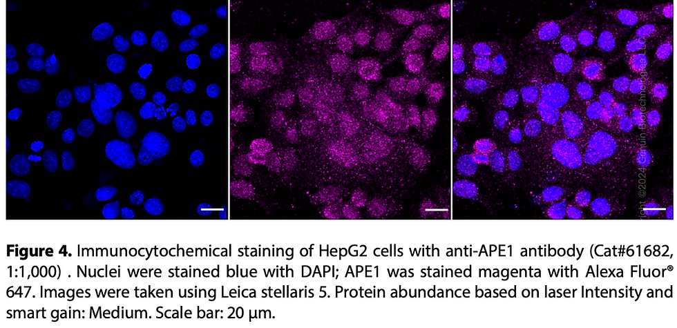 Thumbnail: KD-Validated Anti-APE1 Rabbit Monoclonal Ab#61682