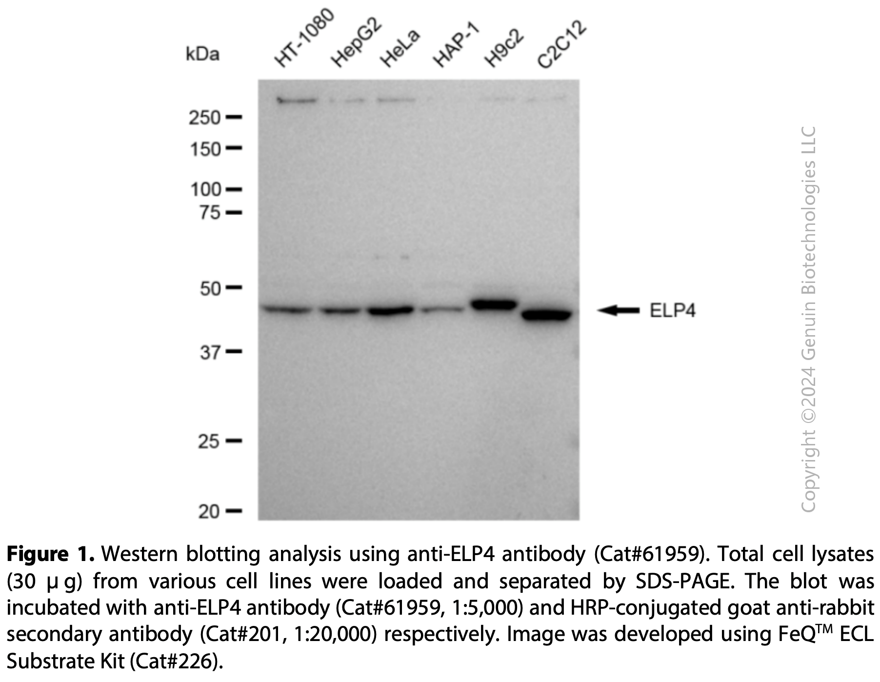 KD-Validated Anti-ELP4 Rabbit mAb#61959