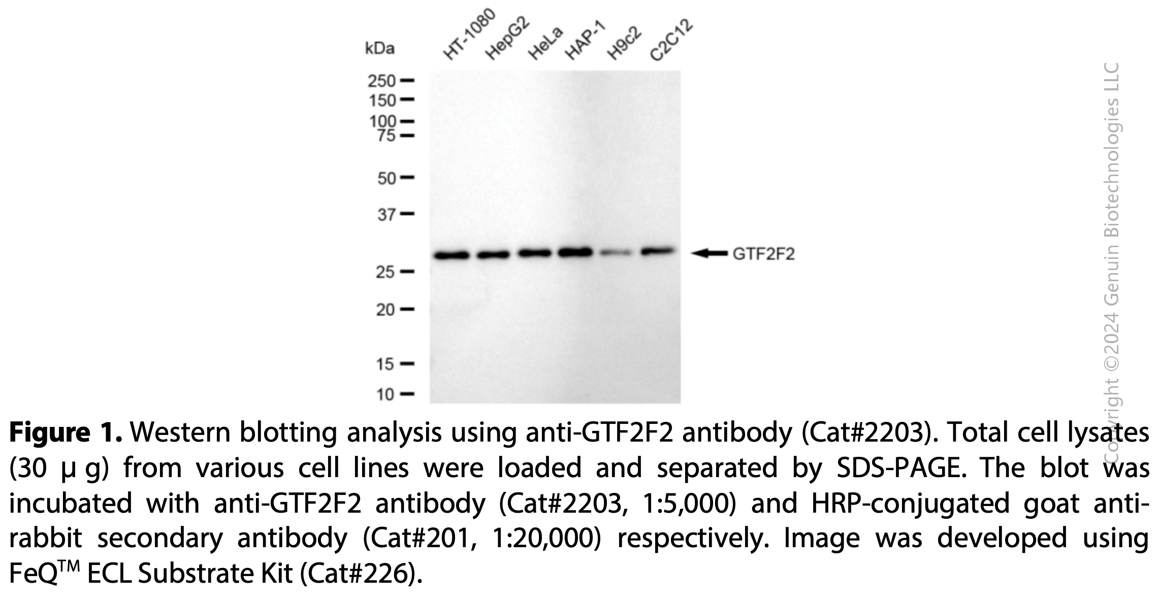 Anti-GTF2F2 Rabbit mAb #2203