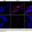 Thumbnail: KD-Validated Anti-CLPP Rabbit Monoclonal Ab #68466
