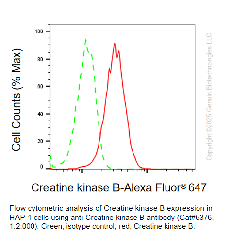 Thumbnail: Anti-Creatine Kinase B Mouse Monoclonal Ab #5376