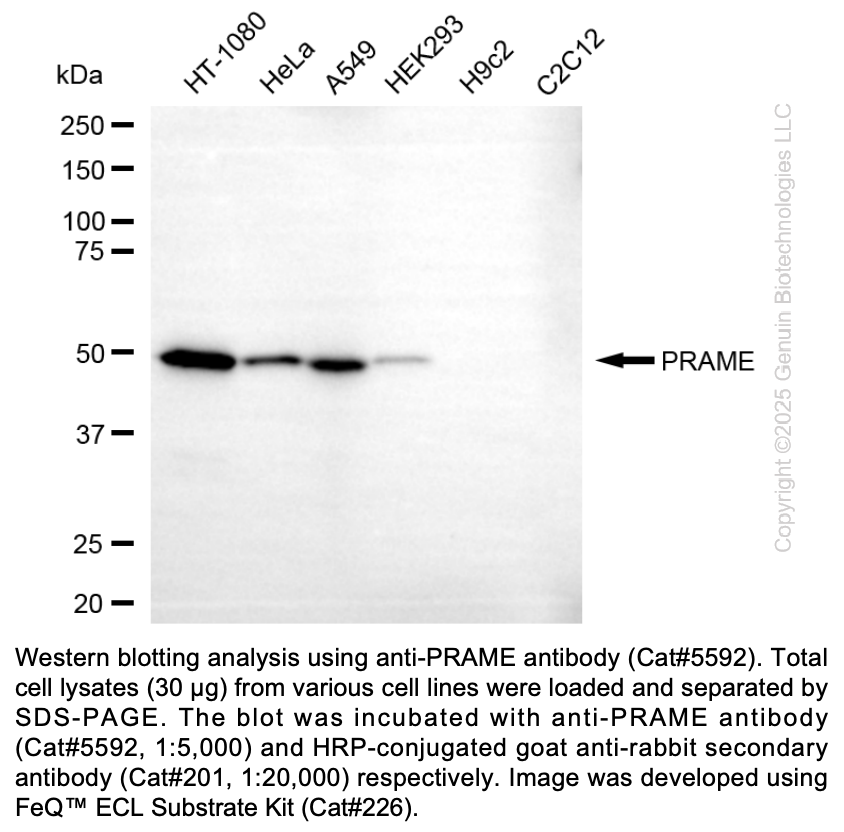 Anti-PRAME Rabbit Monoclonal Ab #5592