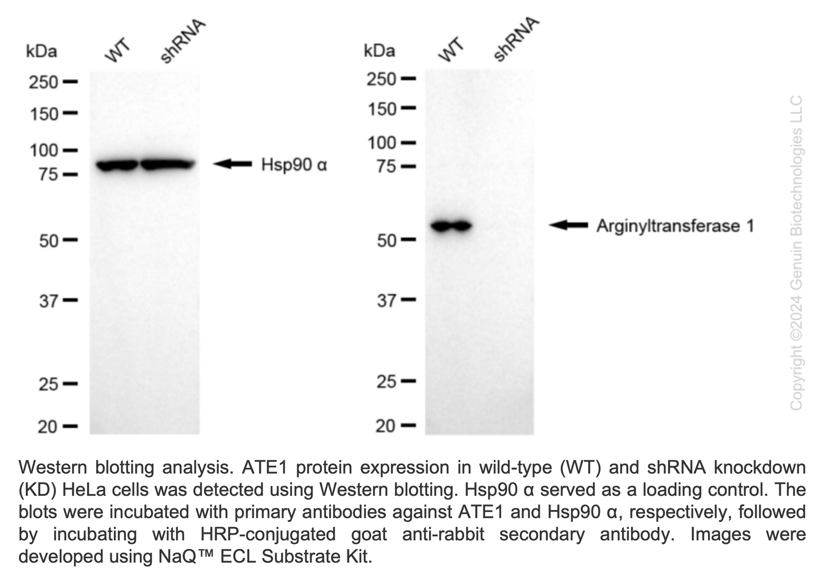 WB-Validated ATE1 Lentiviral shRNA Knockdown Kit#V63253