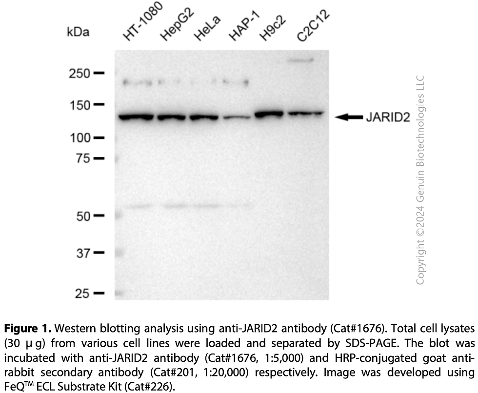 Thumbnail: Anti-JARID2 Rabbit mAb #1676