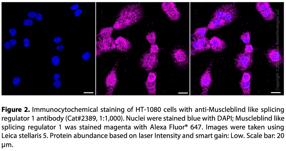 Thumbnail: Anti-Muscleblind Like Splicing Regulator 1 Rabbit mAb #2389
