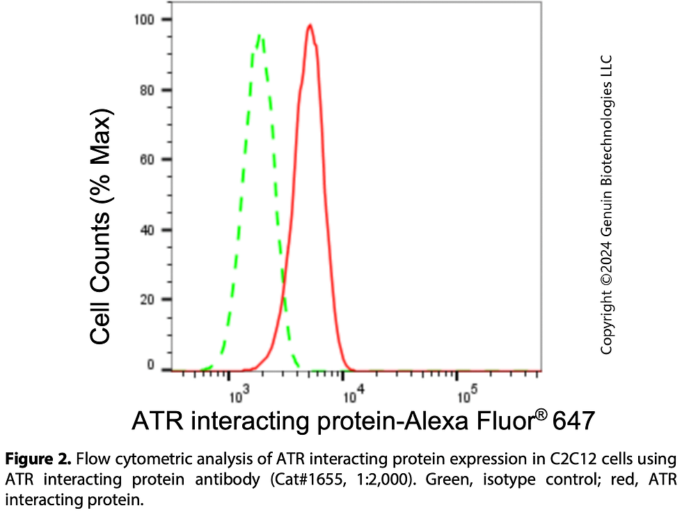 Thumbnail: Anti-ATR Interacting Protein Rabbit mAb #1655