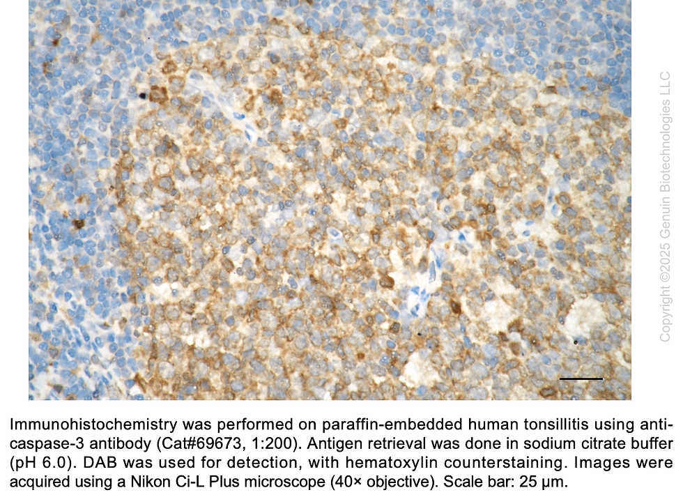 Thumbnail: KD-Validated Anti-Caspase 3 Rabbit Monoclonal Ab#69673
