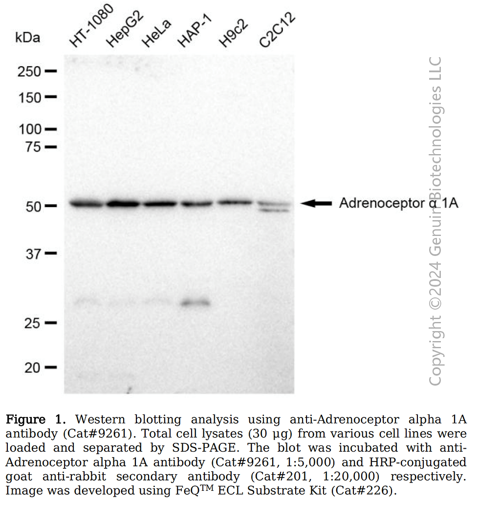 Thumbnail: Anti-Adrenoceptor Alpha 1A Rabbit mAb #9261