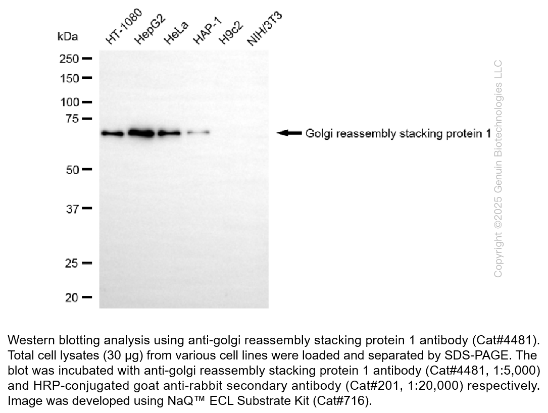 Anti-Golgi Reassembly Stacking Protein 1 Rabbit Monoclonal Ab #4481