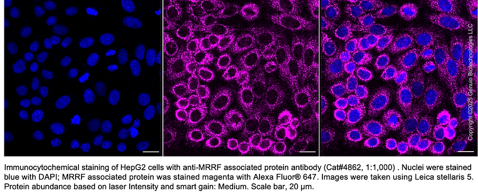 Thumbnail: Anti-MRRF Mouse Monoclonal Ab #4862