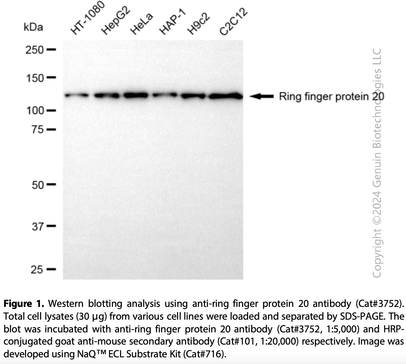 Anti-Ring Finger Protein 20 Mouse Monoclonal Ab #3752