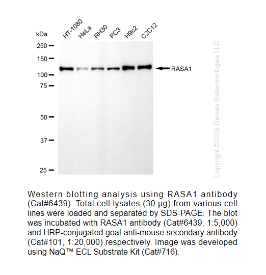 RASA1 Mouse mAb #6439