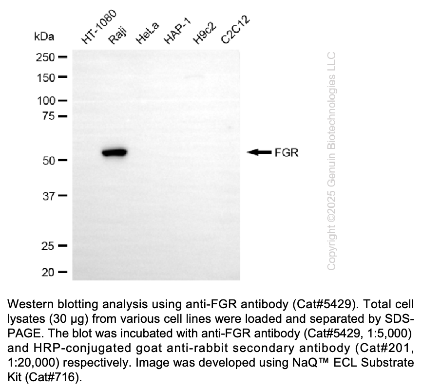 Anti-FGR Rabbit mAb #5429