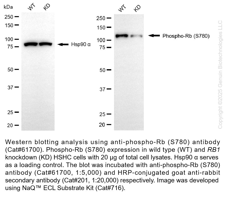 Thumbnail: KD-Validated Anti-Phospho-Retinoblastoma (S780) Rabbit mAb #61700