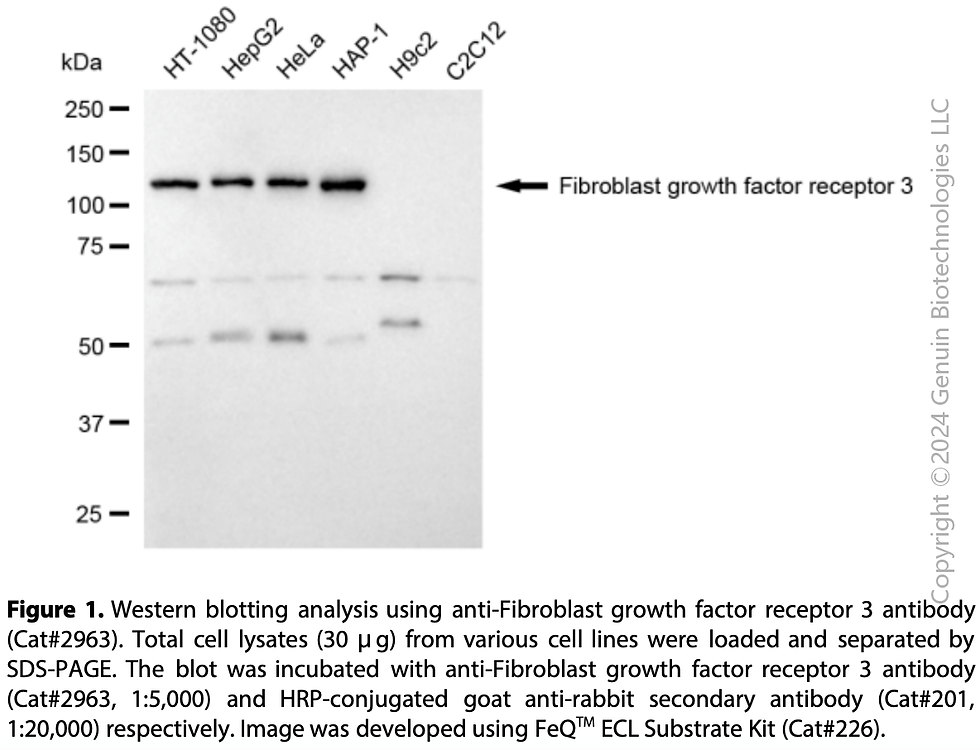 Thumbnail: Anti-Fibroblast Growth Factor Receptor 3 Rabbit mAb #2963