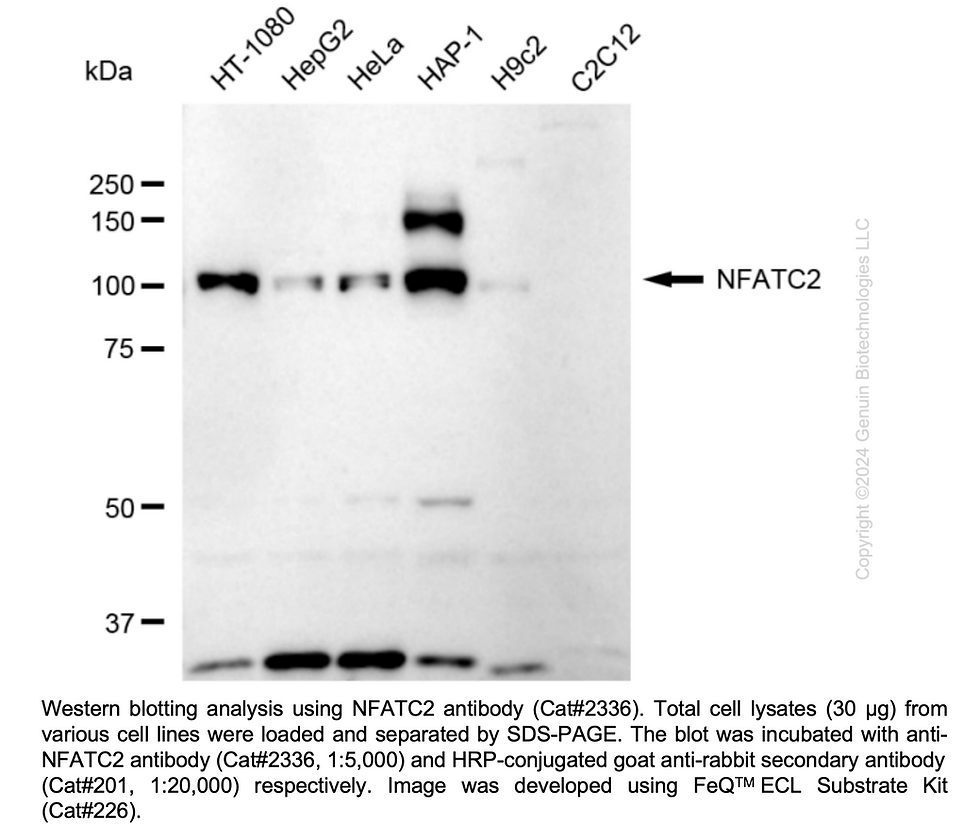 Thumbnail: Anti-NFATC2 Rabbit mAb #2336
