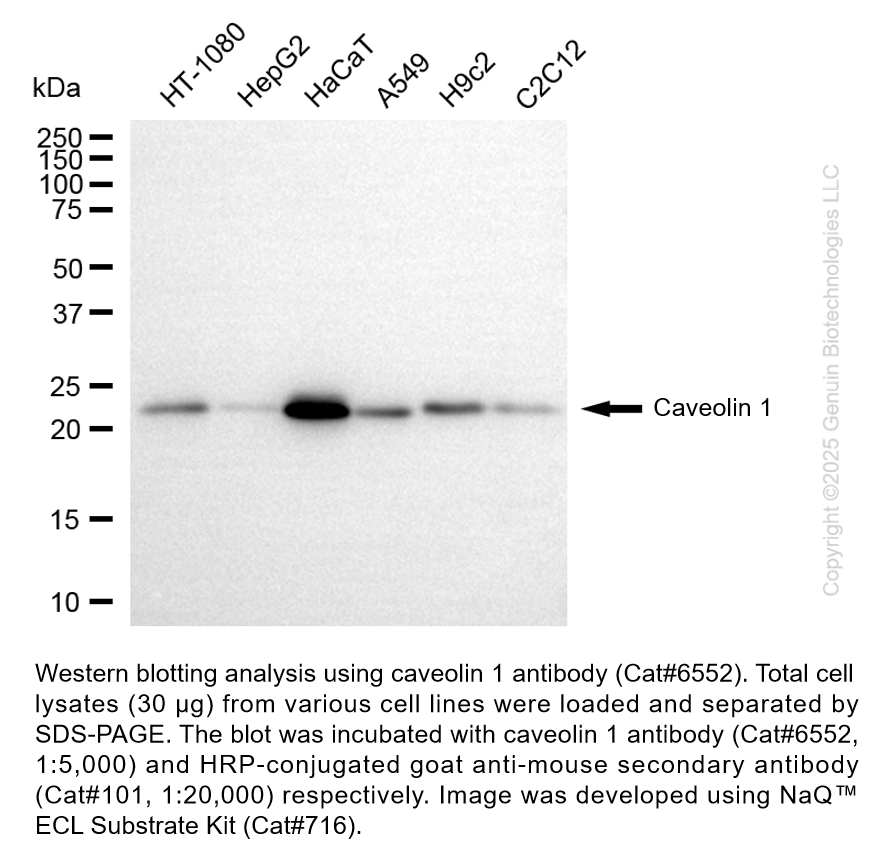 Caveolin 1 Mouse mAb #6552