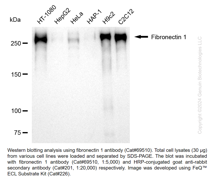 KD-Validated Anti-Fibronectin 1 Rabbit Monoclonal Ab#69510