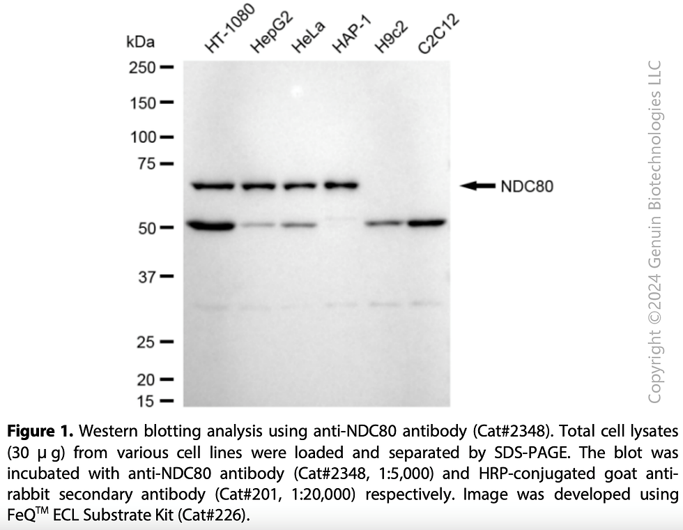 Thumbnail: Anti-NDC80 Rabbit mAb #2348