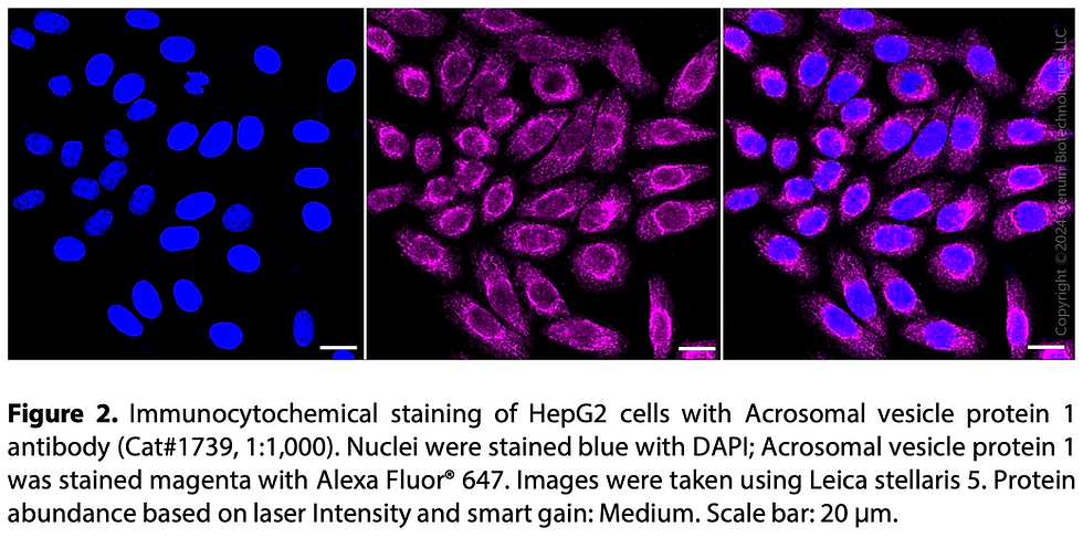 Thumbnail: Anti-Acrosomal Vesicle Protein 1 Rabbit mAb #1739