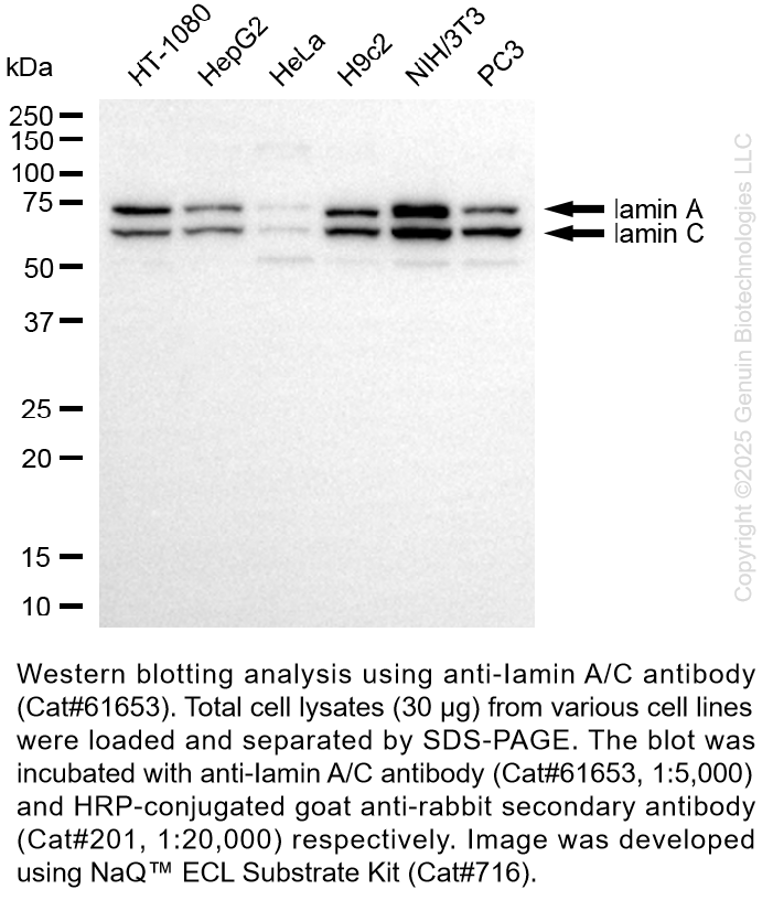 KD-Validated Anti-Lamin A/C Rabbit Monoclonal Ab #61653