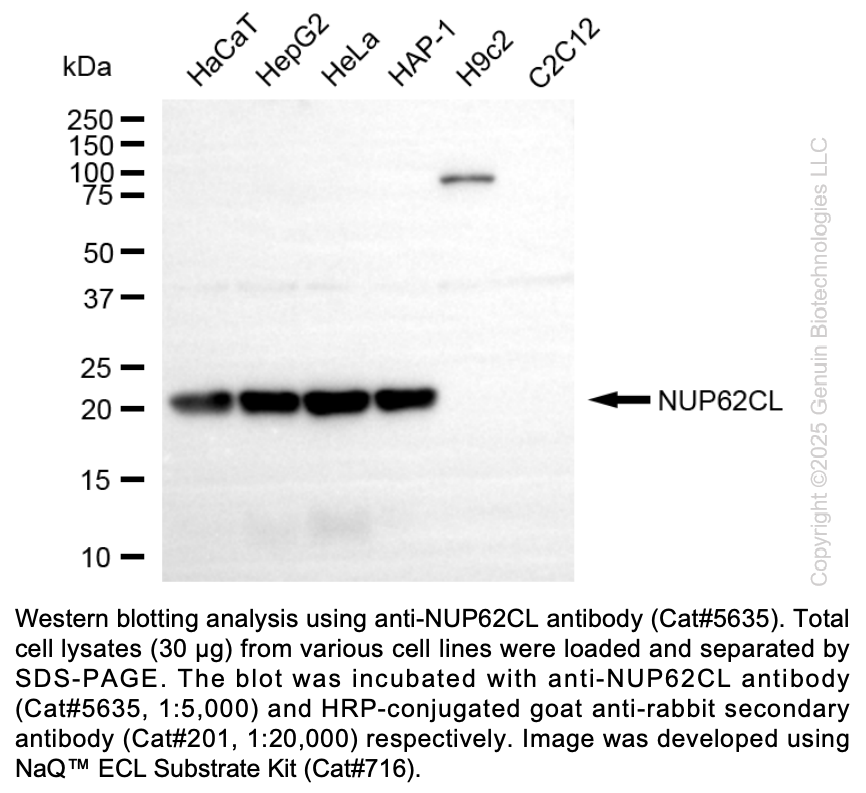 Anti-NUP62CL Rabbit Monoclonal Ab #5635