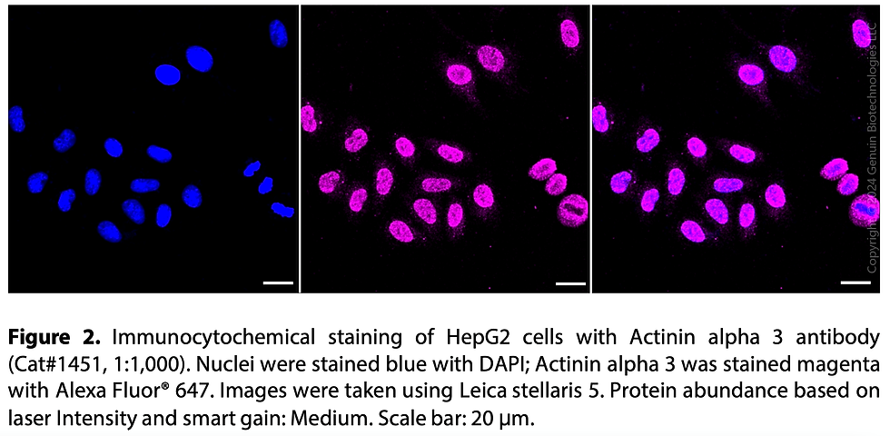 Thumbnail: Anti-Actinin alpha 3 Rabbit mAb #1451